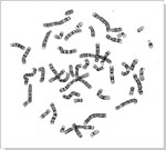 Metaphase