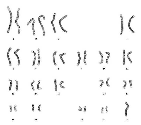 Peripheral blood karyotype